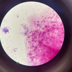 23. Comunicar hallazgos al médico