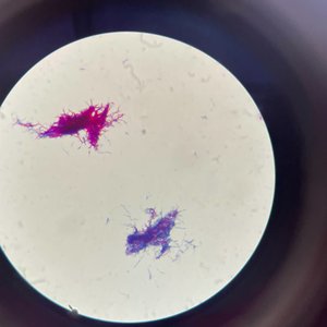 21. Identificando una Nocardia