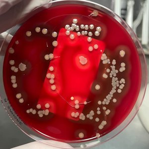 15. Microbiología a distancia gracias a las imágenes
