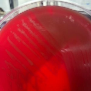 10. Análisis de muestras clínicas